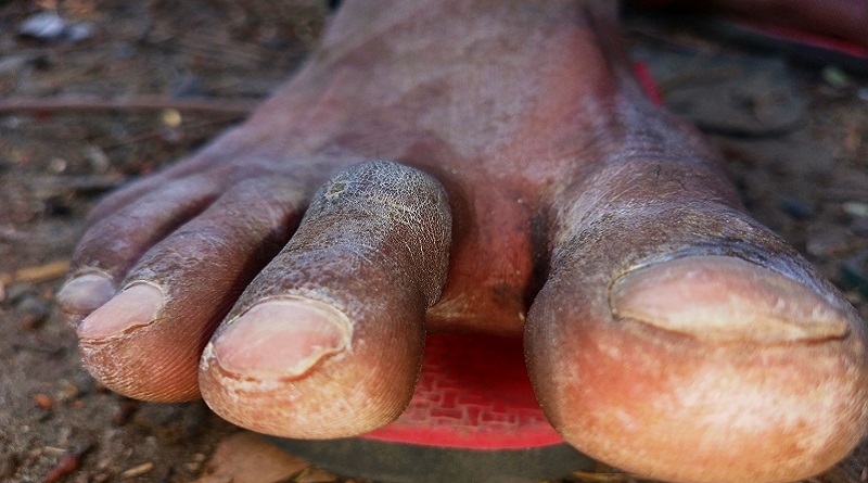 bare foot worker on the nh24