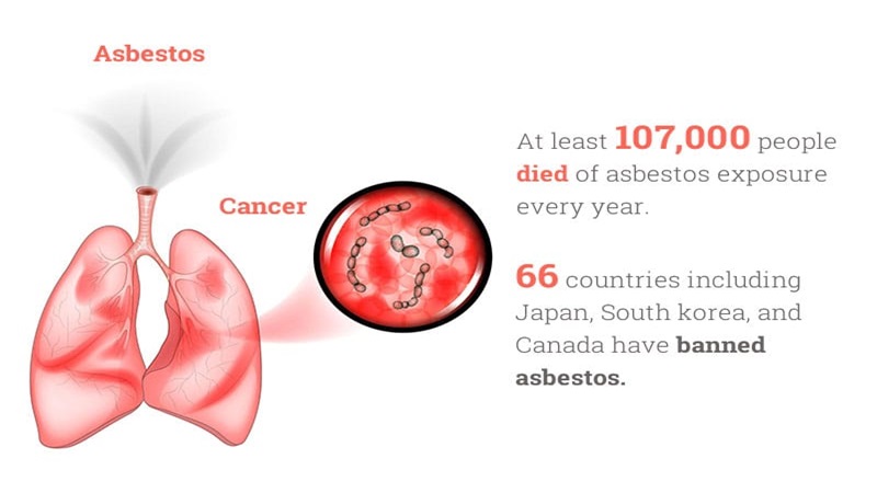 lungs cancer