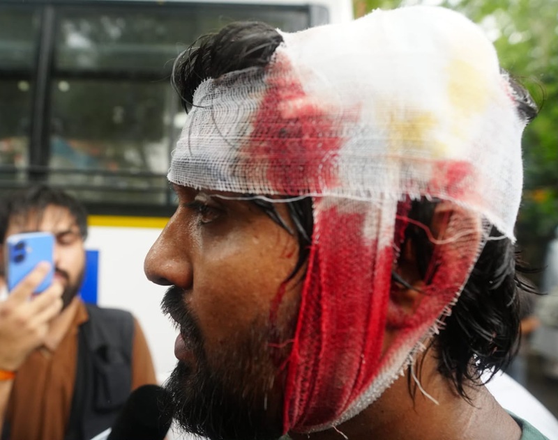 youth protest INJURED
